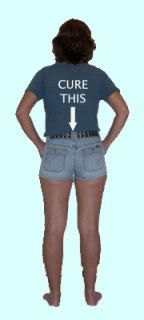 Picture of ABFH's backside in short shorts, with a T-shirt that says CURE THIS and an arrow pointing down.