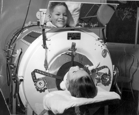 photo ironlung-mirror_zps91hlqg3q.png