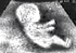 DrivingFetus.gif image by rdrhoades